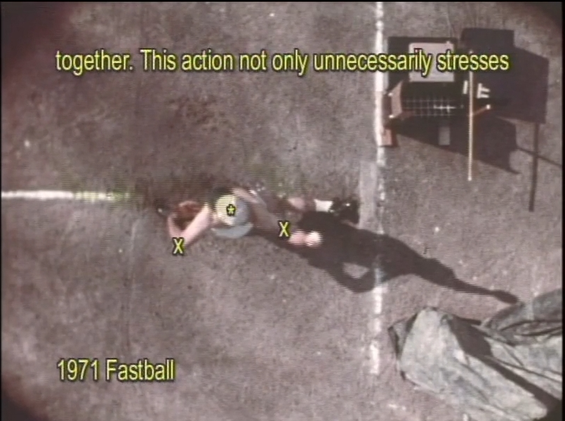 1971 overhead film still of Dr. Mike Marshall throwing a fastball; annotated to expose Subscapularis Detachment caused by scapular compression and centripetal elbow force in traditional pitching motion